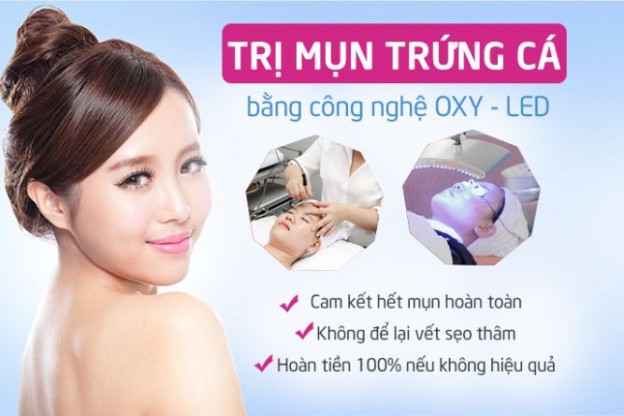 trị mụn chứng cá bằng công nghệ Oxy-led